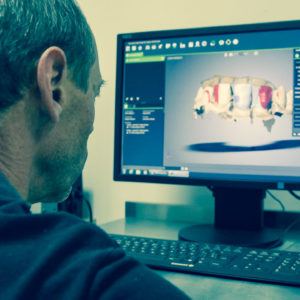 Escaneo con sistema Straumann