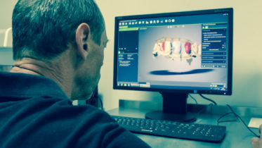 Escaneo con sistema Straumann