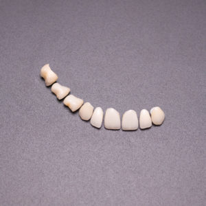 Coronas y carillas de e-max estratificadas Coronas y carillas de e-max estratificadas