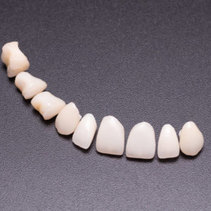 Coronas y carillas de e-max estratificadas Coronas y carillas de e-max estratificadas