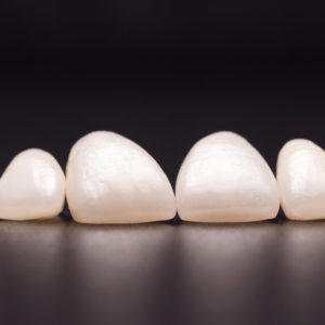 Coronas y carillas de e-max estratificadas Coronas y carillas de e-max estratificadas