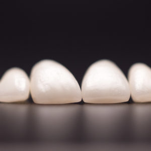 Coronas y carillas de e-max estratificadas Coronas y carillas de e-max estratificadas