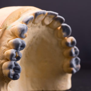 Encerado diagnostico Encerado diagnostico