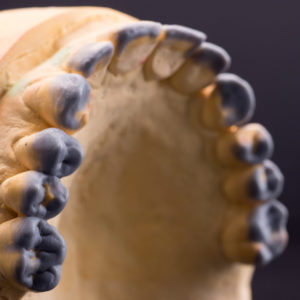 Encerado diagnostico Encerado diagnostico