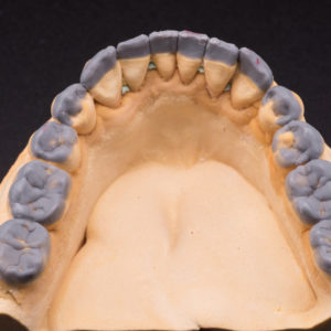 Encerado diagnostico Encerado diagnostico