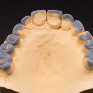 Encerado diagnostico Encerado diagnostico