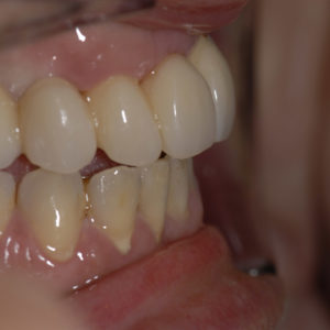 Hibrida Superior Hibrida Superior