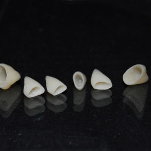 Coronas E-max Coronas E-max