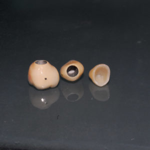 Coronas individuales Coronas individuales