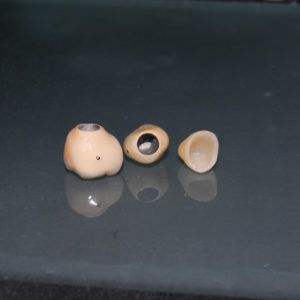 Coronas individuales Coronas individuales