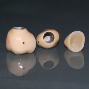 Coronas individuales Coronas individuales